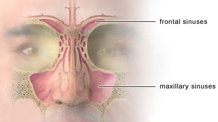 Cuanto cuesta una operacion por sinusitis Cuanto cuesta una operacion por sinusitis